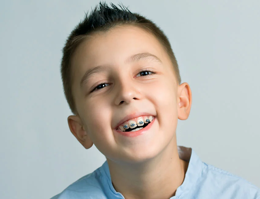 Child Two-Phase Orthodontic treatment in Woodland Hills, CA
